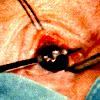 oeil pour oeil