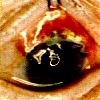 Eye can see you